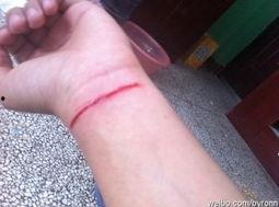 割手腕的图片,揭开生命边缘的残酷真相