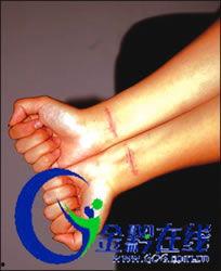 割手腕的图片,揭开生命边缘的残酷真相